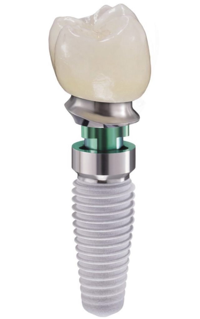 implantologia dental completa implant
