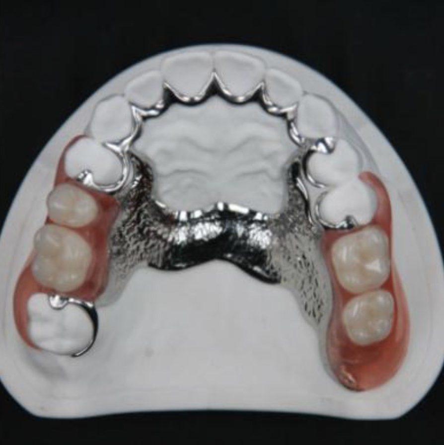 Prótesis dentales barcelona